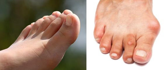 foot
